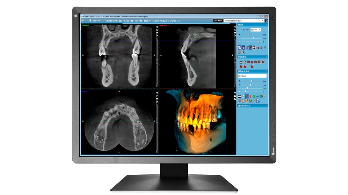 MX216_dental