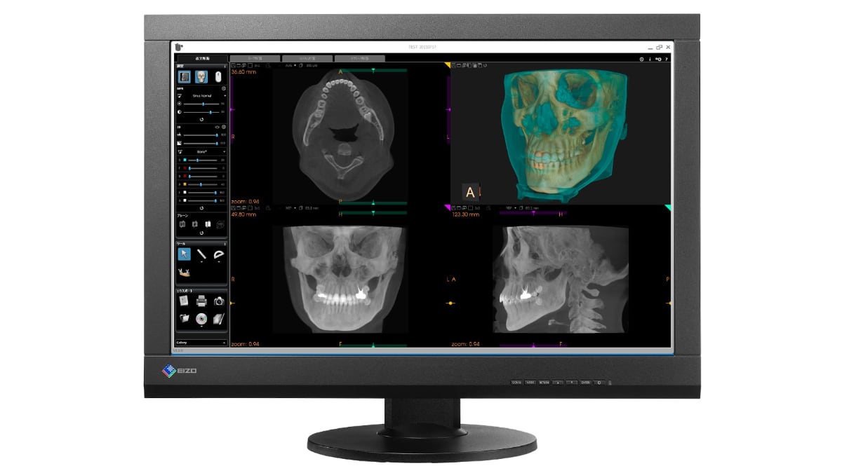 RadiForceMX242W_f_dental