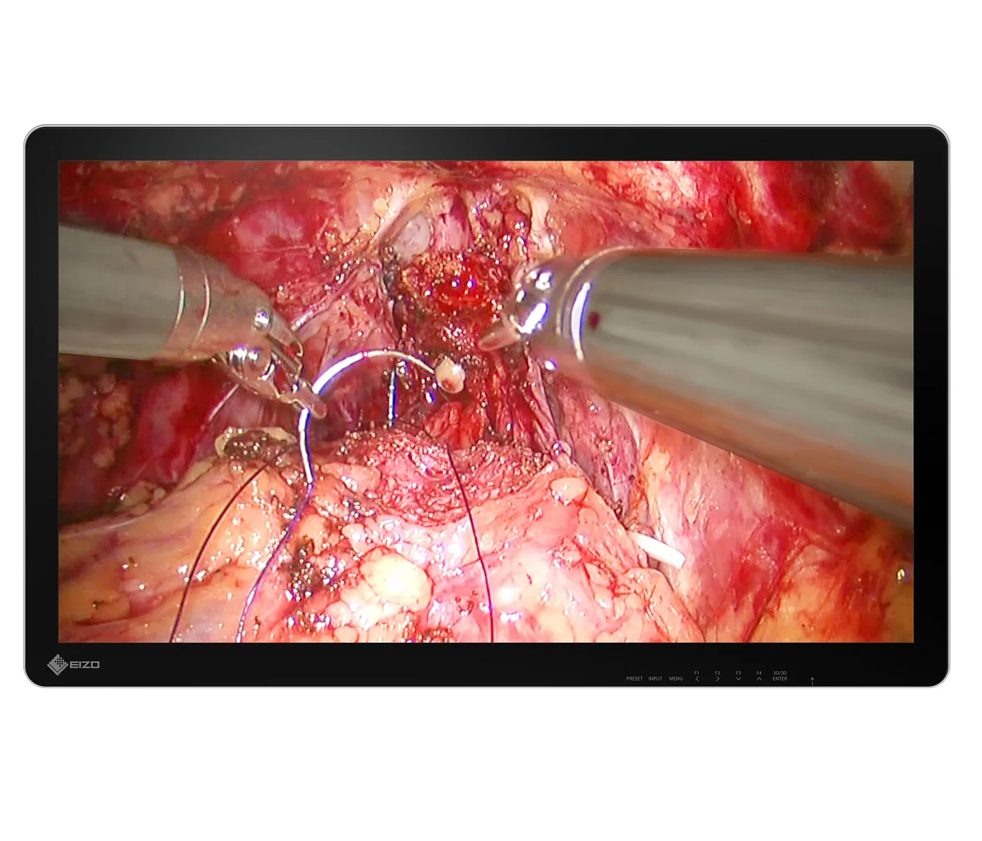 CuratOR-EX3242-3D-endoscopic-monitor-front