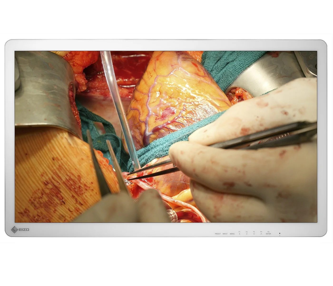 CuratOR-EX3242-endoscopic-monitor-front-1