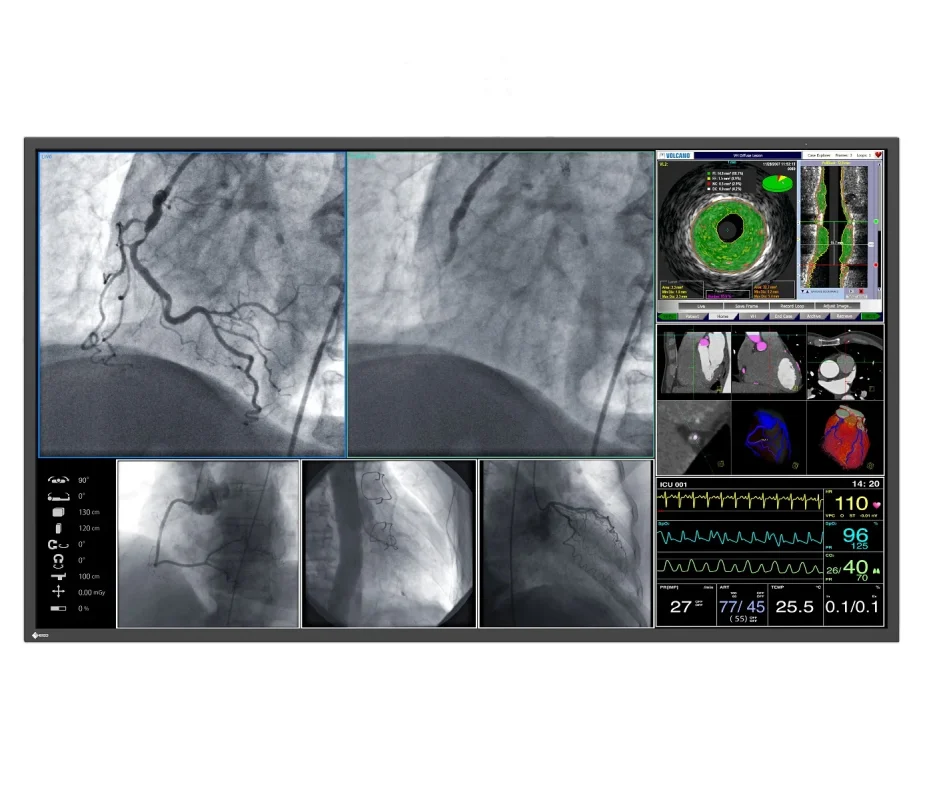 CuratOR-LL550W-Medical-Monitor-Interventional-front-933x800