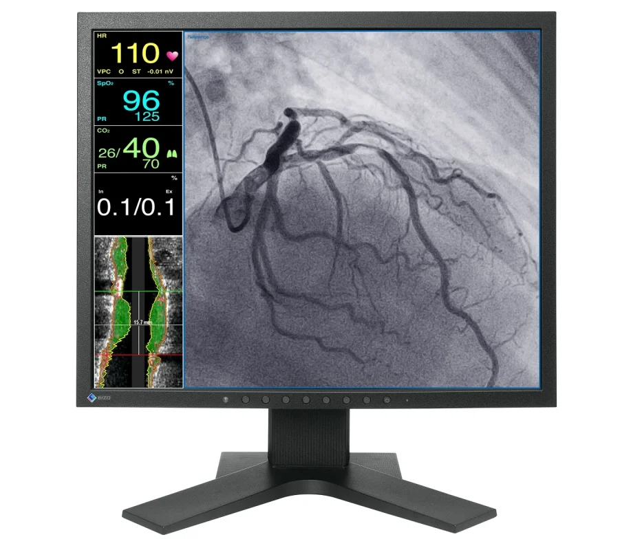 CuratOR-LX1910-Medical-Monitor-Interventional-with-stand-front-933x800
